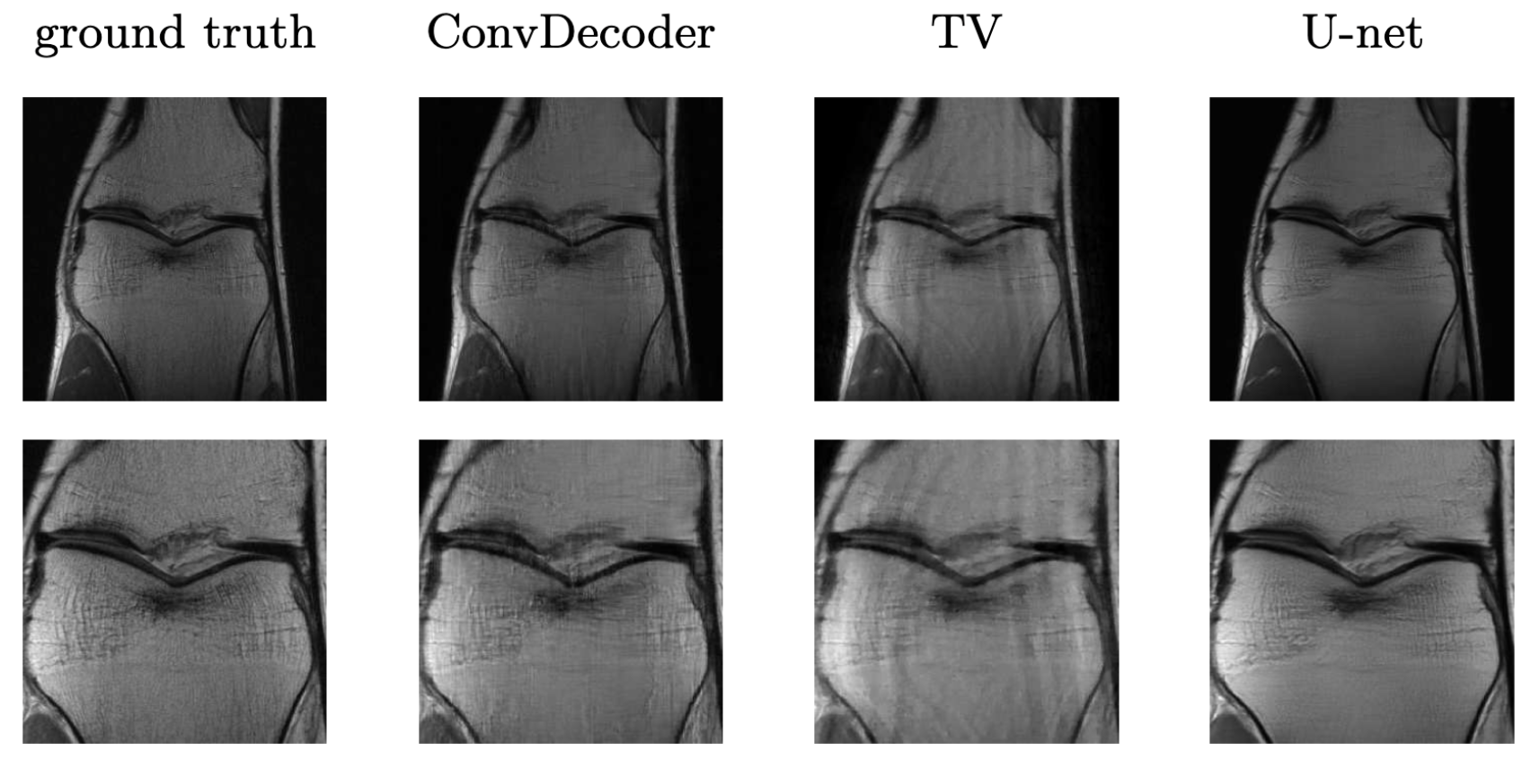 Comparison of the untrained ConvDecoder with the U-Net MRI, and total-variation regularized compressed sensing. Reconstructions of knee-MRI at 4x acceleration. The second row is a zoomed in version of the first row. Figure reproduced from Darestani et al. 2020.